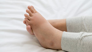 Why are my feet swollen after birth? Understanding & managing postpartum swollen feet. - TheRY