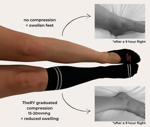 Swollen foot from no compression sock and non swollen foot with compression sock comparison photo